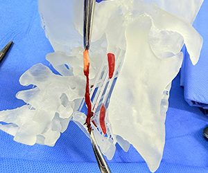 Eagle Syndrome: a little-known cause of persistent facial pain